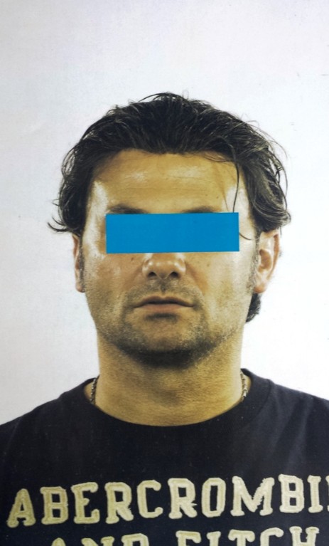 Protesi per capelli Protesi per capelli