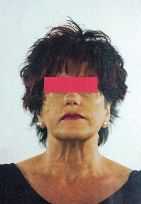 Protesi per capelli Protesi per capelli