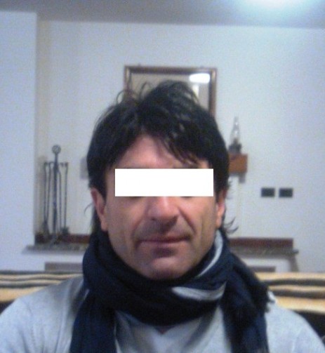 protesi per capelli protesi per capelli